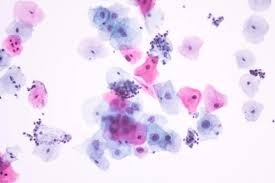 Cytology Non GYN