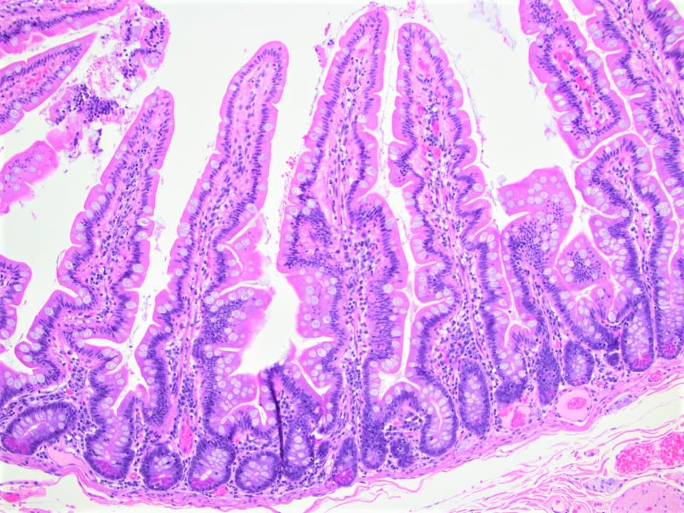 Gastroenterology
