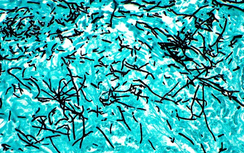 Special Stains & Antibodies