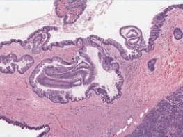 Surgical Pathology